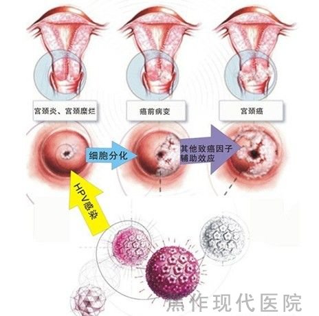 金州治疗宫颈糜烂好的医院是哪家？